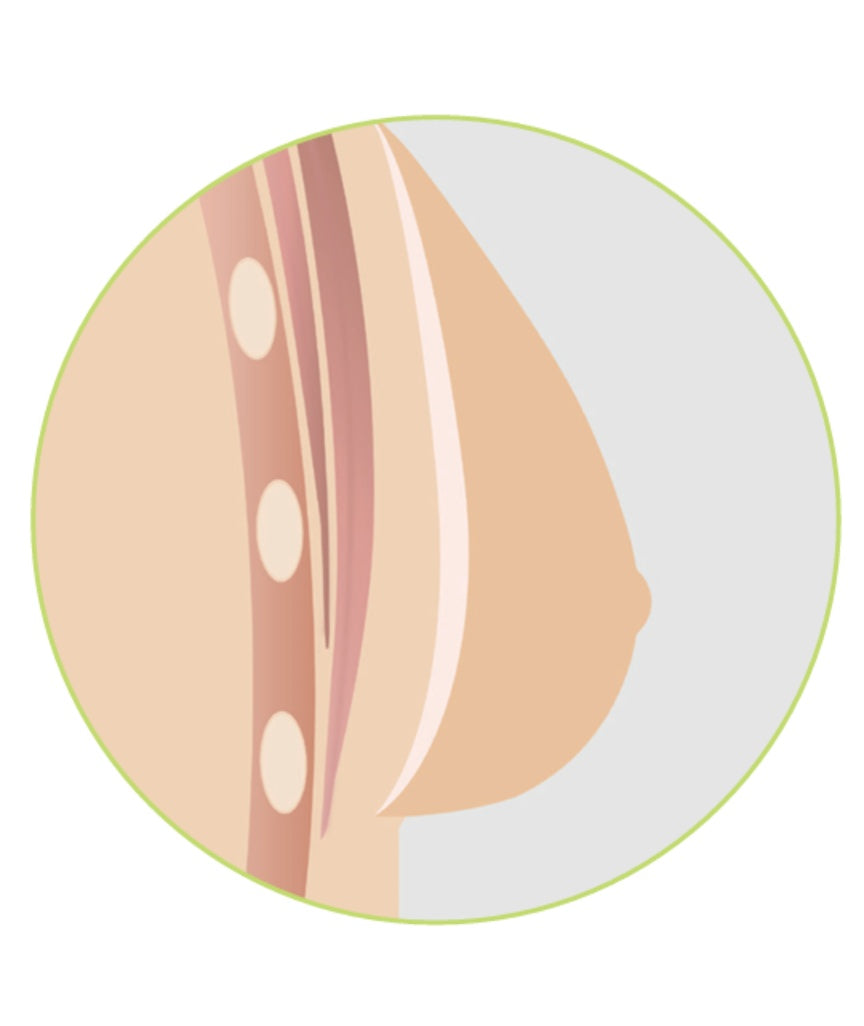 Amoena Natura 1S Breast Form - Ivory