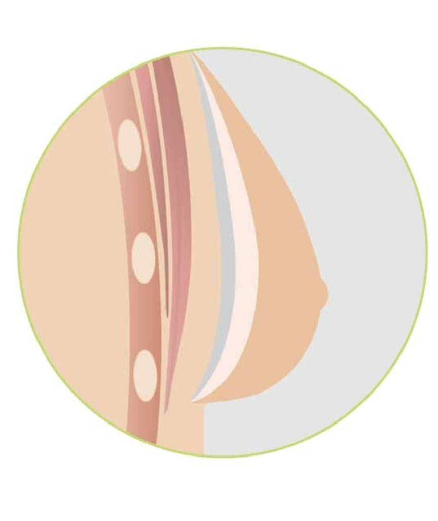 Amoena Natura Cosmetic 3E Breast Form - Ivory (Left)